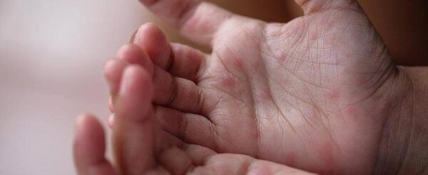 Фото: Яндекс картинки