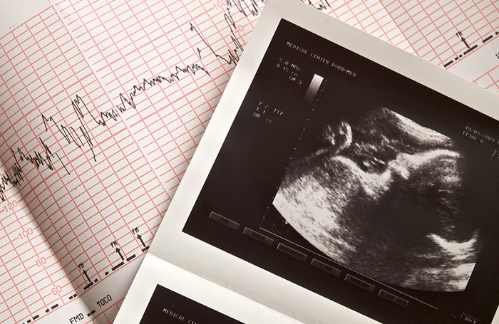    Liseykina/Фотобанк Лори