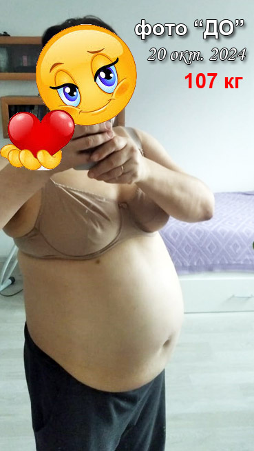 Фото "До", 20 октября 2024г, рост 168см, вес 107кг