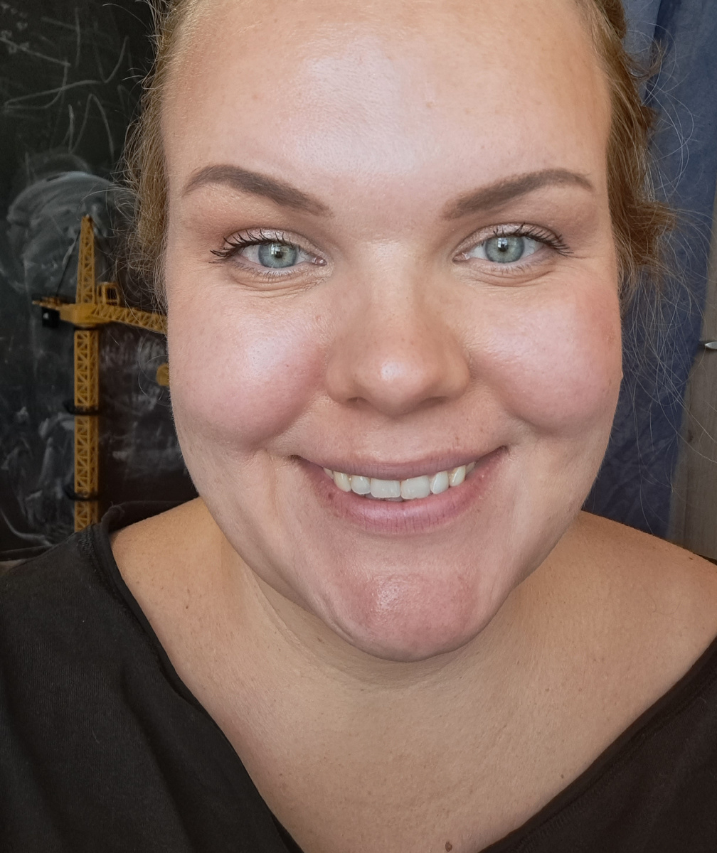 А вот так при улыбке. Сразу собираются гармошки