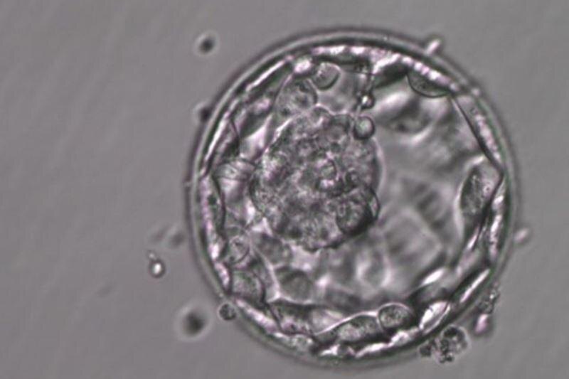    Фото: пресс-служба "УГМК-Здоровье". В сфере репродуктивной медицины внедряются новые методики