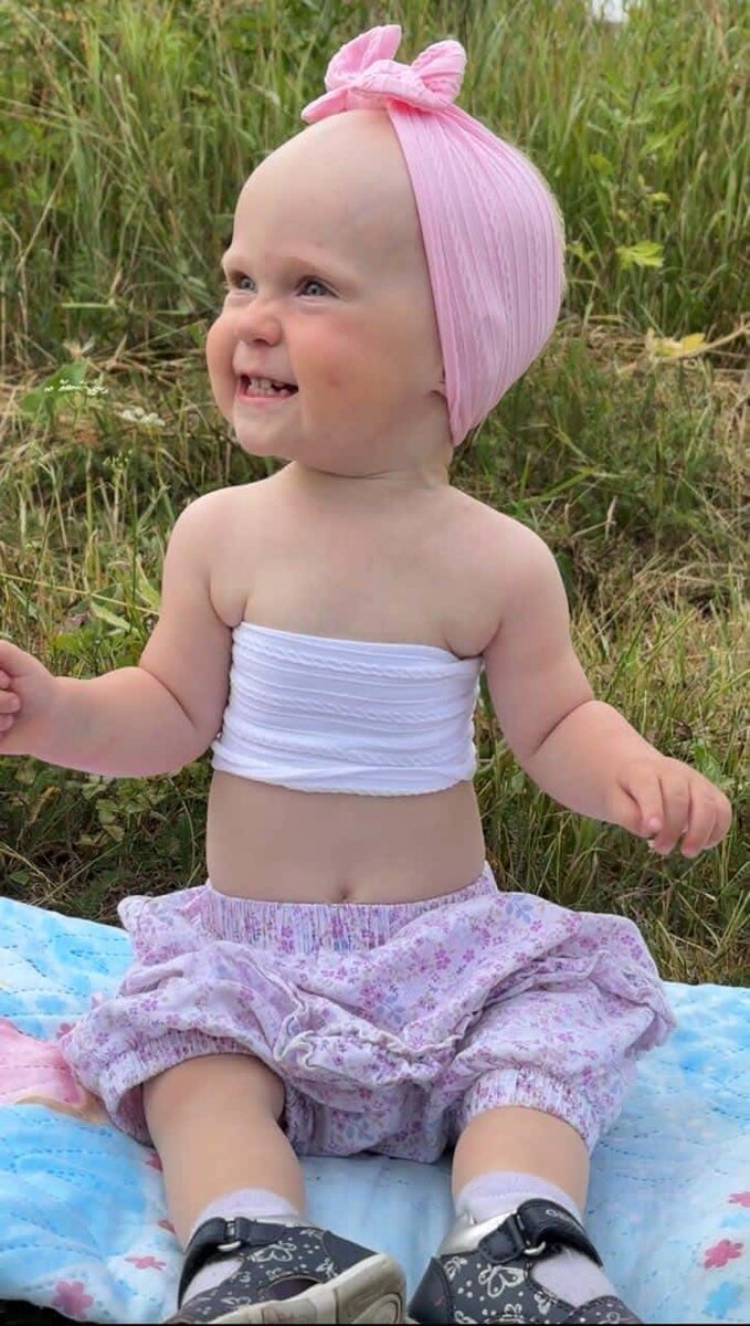 Грудная клетка Агнии напоминает песочные часы — верхние и нижние ребра нормальные, а средние очень узкие. Фото из личного архива.