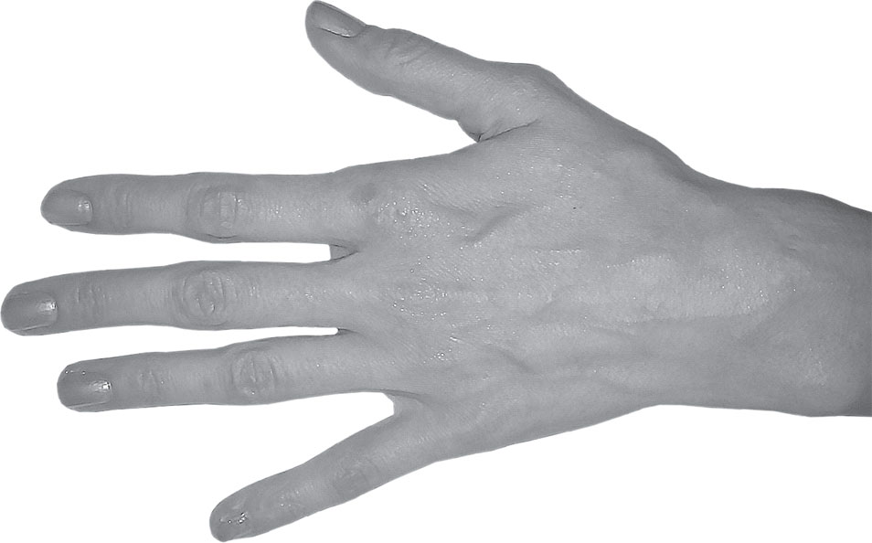 Узловатые пальцы. bookz.ru