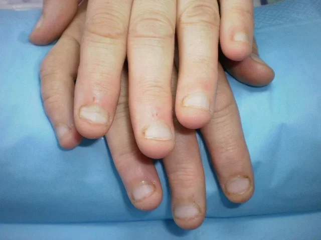 Яндекс.Дзен