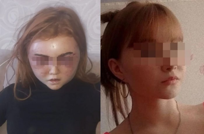 Справа — до избиения, слева — после. Фото «КП-Новосибирск».