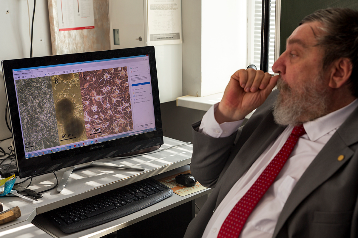 Три стадии восстановления нейронов. Первое изображение — это поражённая раком ткань. Второе — раковые клетки рассасываются. На третьем изображении — здоровая ткань. Фото: Александр Погожев 