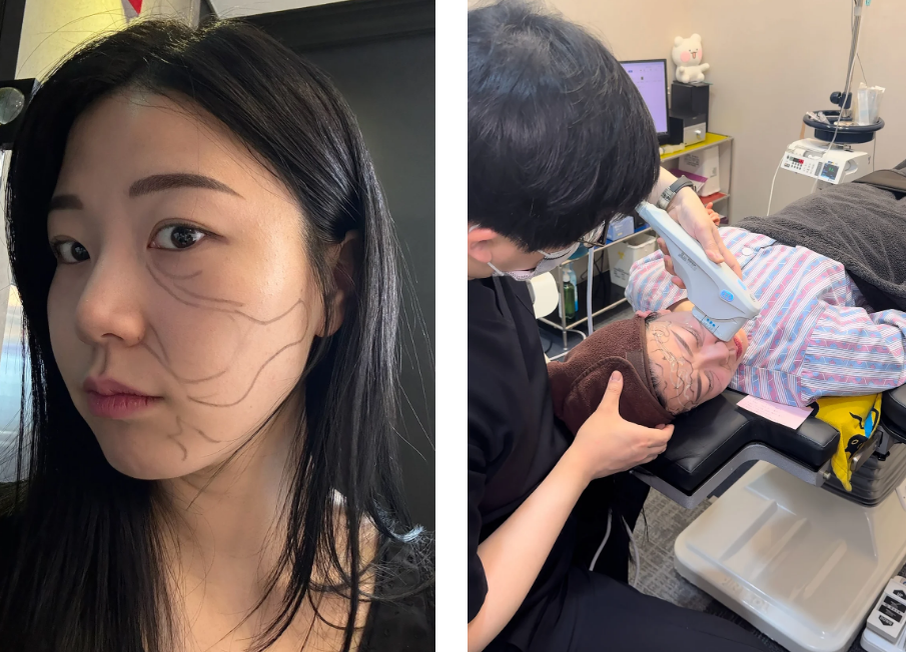 Перед операциями и процедурами: твое лицо - карта захвата Коре