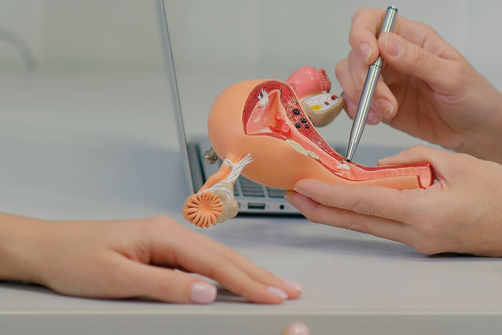 ЭКО при трубном бесплодии