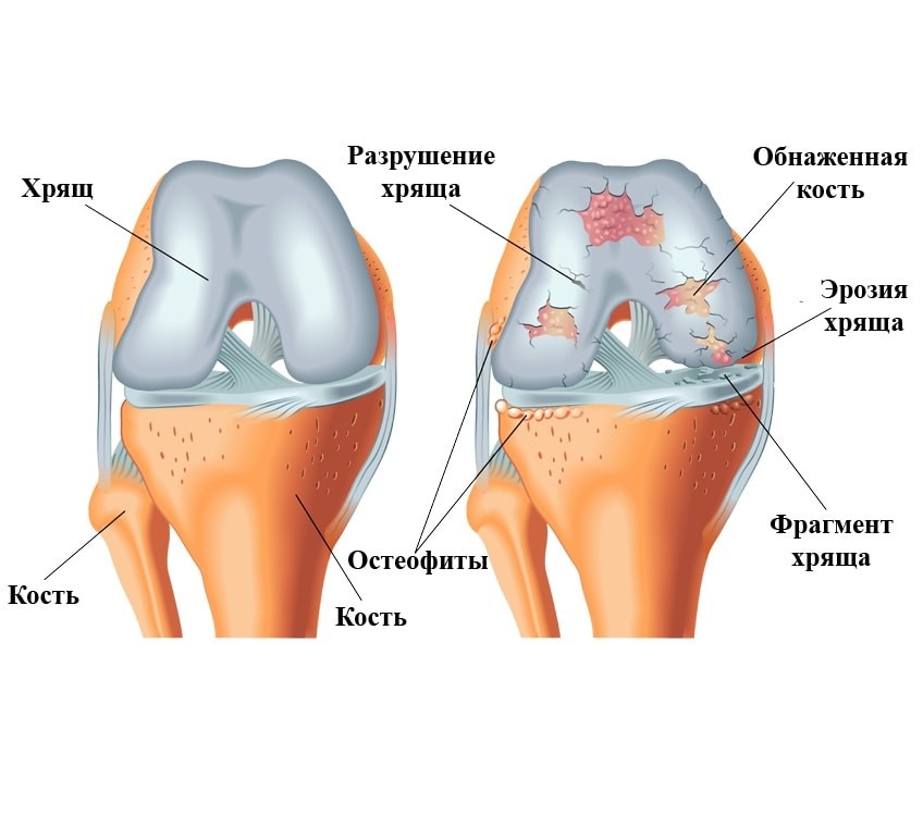 Как подготовить суставы к тренировке?