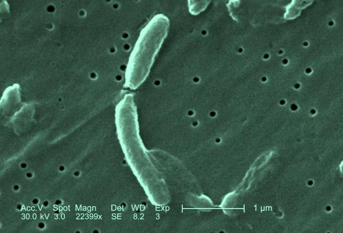 Изображение двух бактерий Vibrio cholerae, увеличенное в 22399 раз, полученное с помощью сканирующего электронного микроскопа. Фото: CDC/Дженис Хейни Карр 
