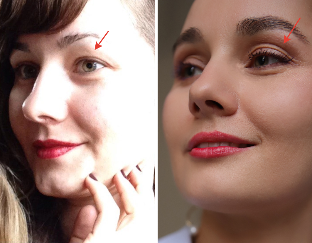 Мои веки в 29 лет и в 38 лет