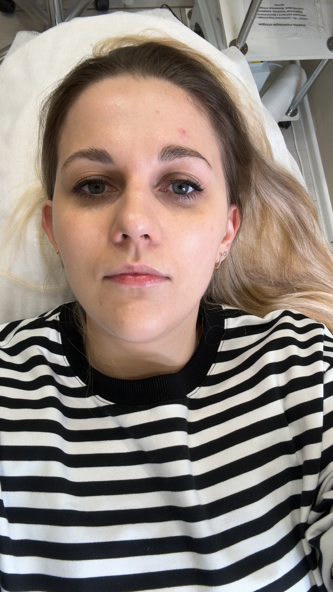 Мои натуральные губы