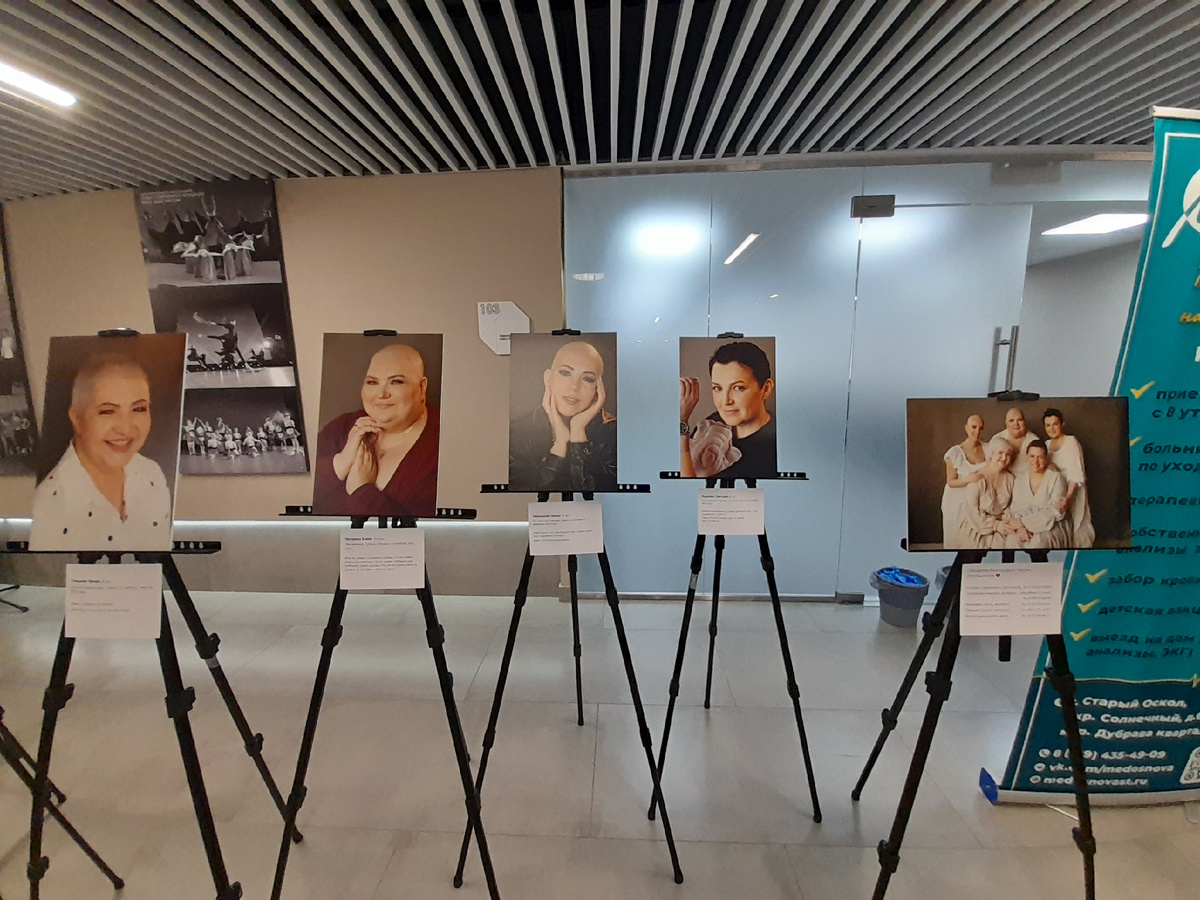 Фото женщин, у кого рак. Я на двух фотографиях 