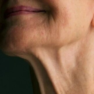 Индюшачья шея