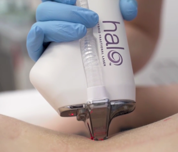 ИМЕЮТСЯ ПРОТИВОПОКАЗАНИЯ, НЕОБХОДИМА КОНСУЛЬТАЦИЯ СПЕЦИАЛИСТА