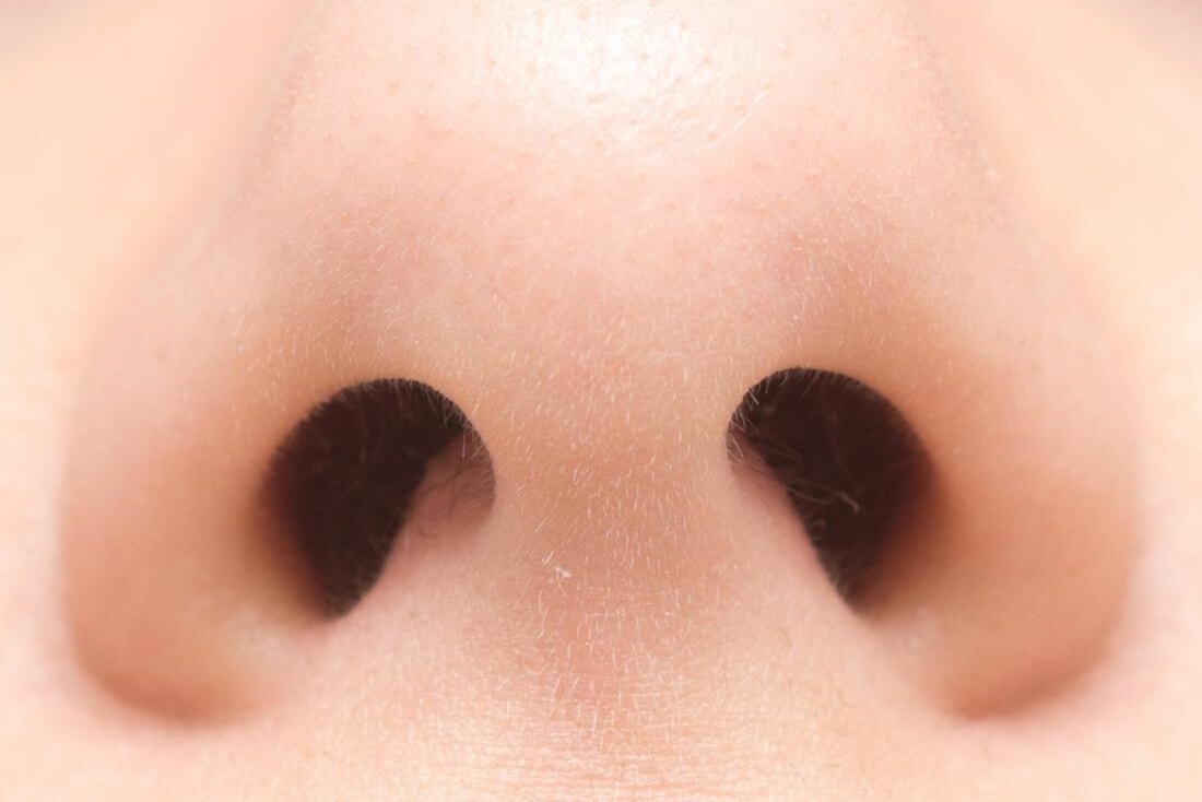     Что делать, если вскочил прыщ в носу: 4 совета дерматологов