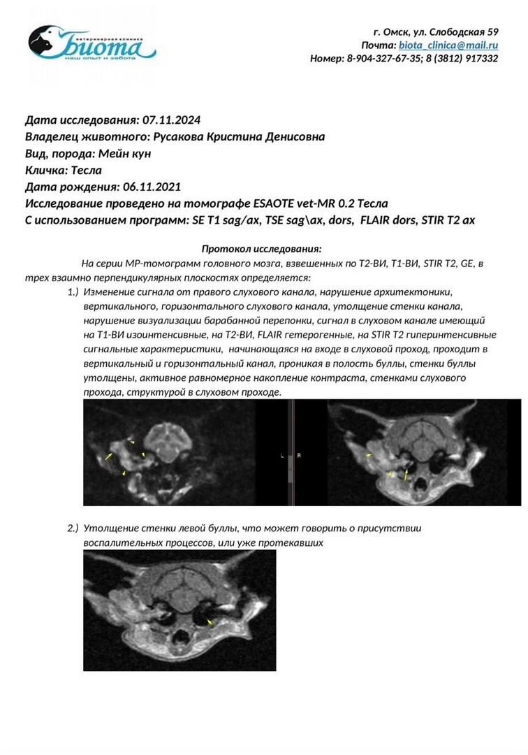 Результаты МРТ Теслы и то, что предстоит сделать, еси найдем деньги...