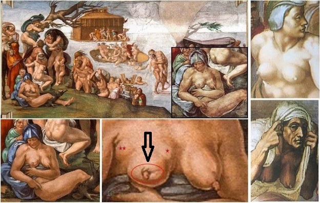 На фреске Микеланджело "Великий потоп" изображена женщина, страдающая раком молочной железы.