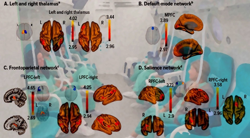   N + 1; Keren Doenyas-Barak et al. / The Journal of Clinical Psychiatry, 2024; The Shamir Medical Center