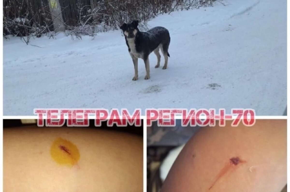    Бастрыкин поручил возбудить дело о нападении собак на детей в Томске