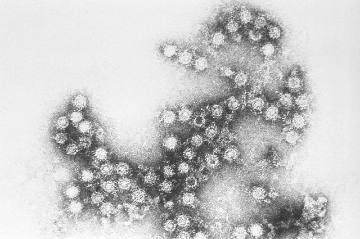    Нижегородка заразилась вирусом Коксаки