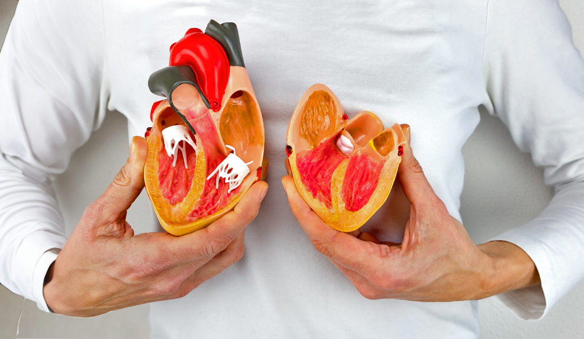 Инфаркт: когда сердце кричит "Хватит!" 💔 Как не пропустить сигнал SOS от главного органа. Руководство по спасению для чайников 🚑