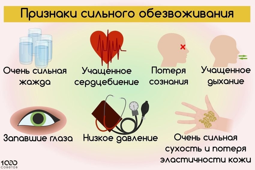 Симптомы дегидрации: