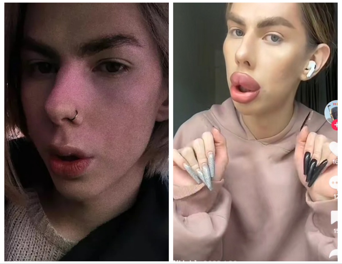 -9