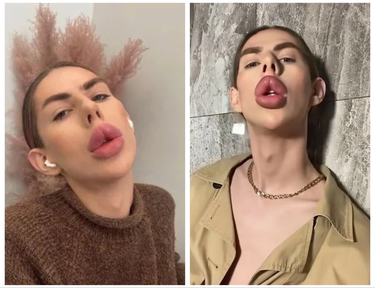 -10