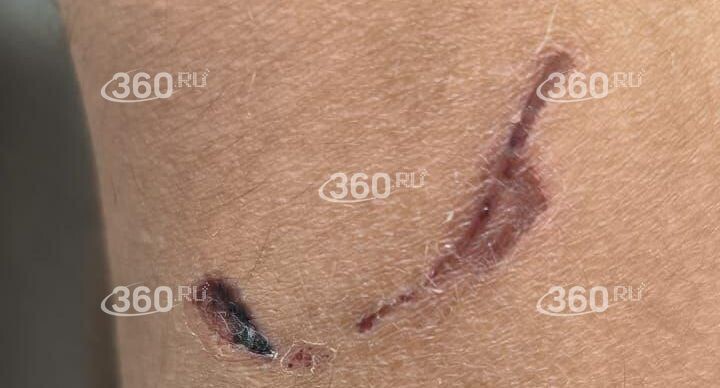    Телеканал «360»