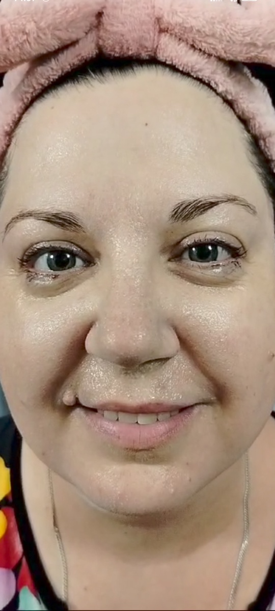 Фото автора канала, в процессе очищения кожи лица 