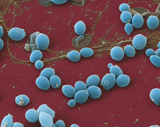 Candida albicans. Иллюстрация: hartmann-science-center.com 