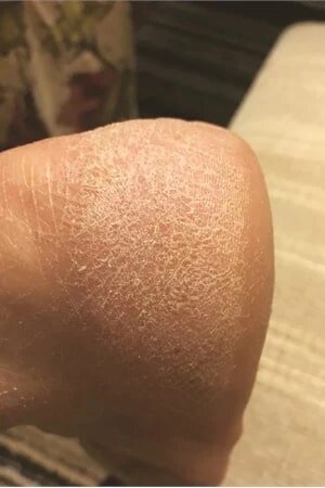    До маски из глиныФото: соцсети