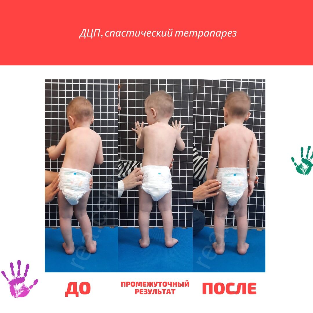 Результат за 10 дней центра «Добрые руки»