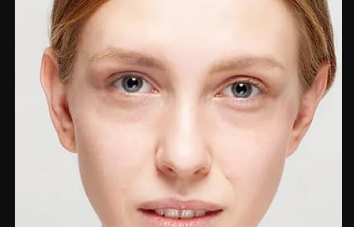    Бледность кожи: почему она возникает и чем может грозить организму