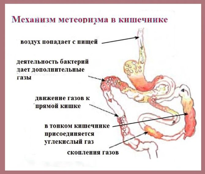Газы в животе не выходят