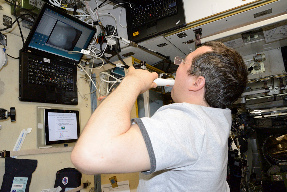 Космонавт участвует в медицинском обследовании на борту МКС. Фото: Роскосмос