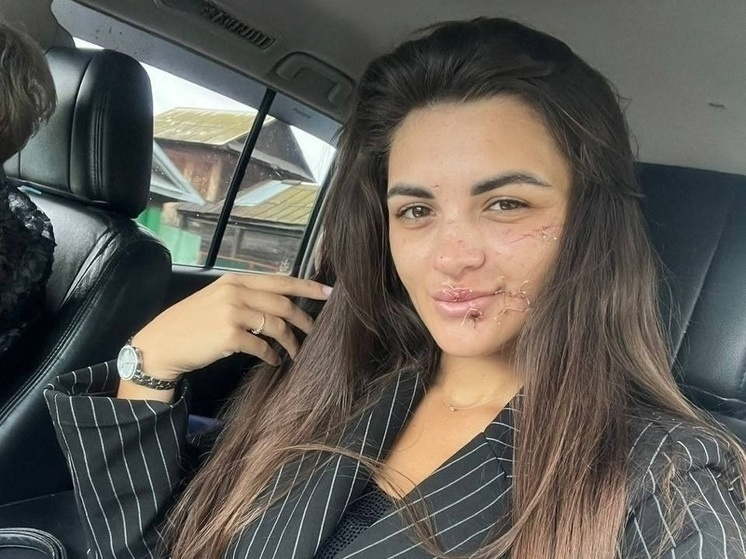 Фото потерпевшей: опубликовано «МК на Алтае»