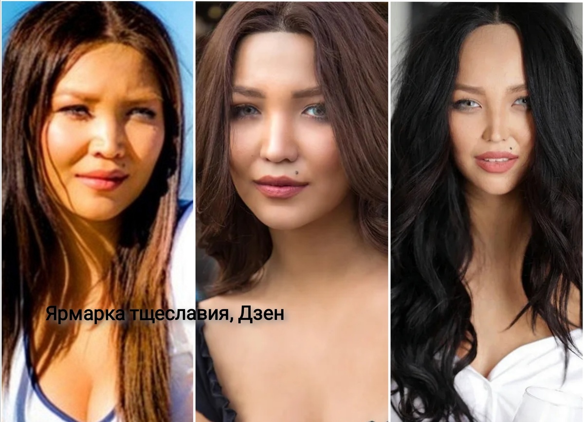 Этапы пластики Дарины Эрвин