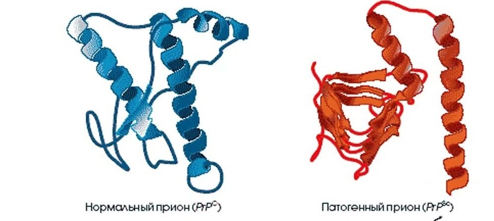 Пространственное различие в структуре между нормальным белком (преобладают α-тяжи) и прионом (в последнем преобладают β-тяжи, около 43%). 