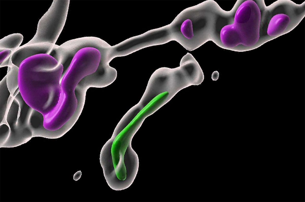 Два разных вида митохондрий, обозначенные зеленым и фиолетовым цветом, образуются в клетках, испытывающих недостаток питательных веществ. Иллюстрация: Tak Shun Fung