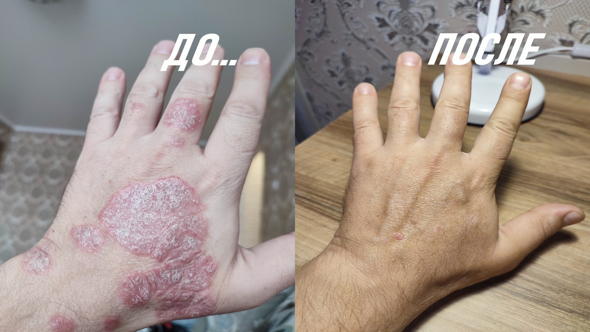 Результат через 3 месяца.