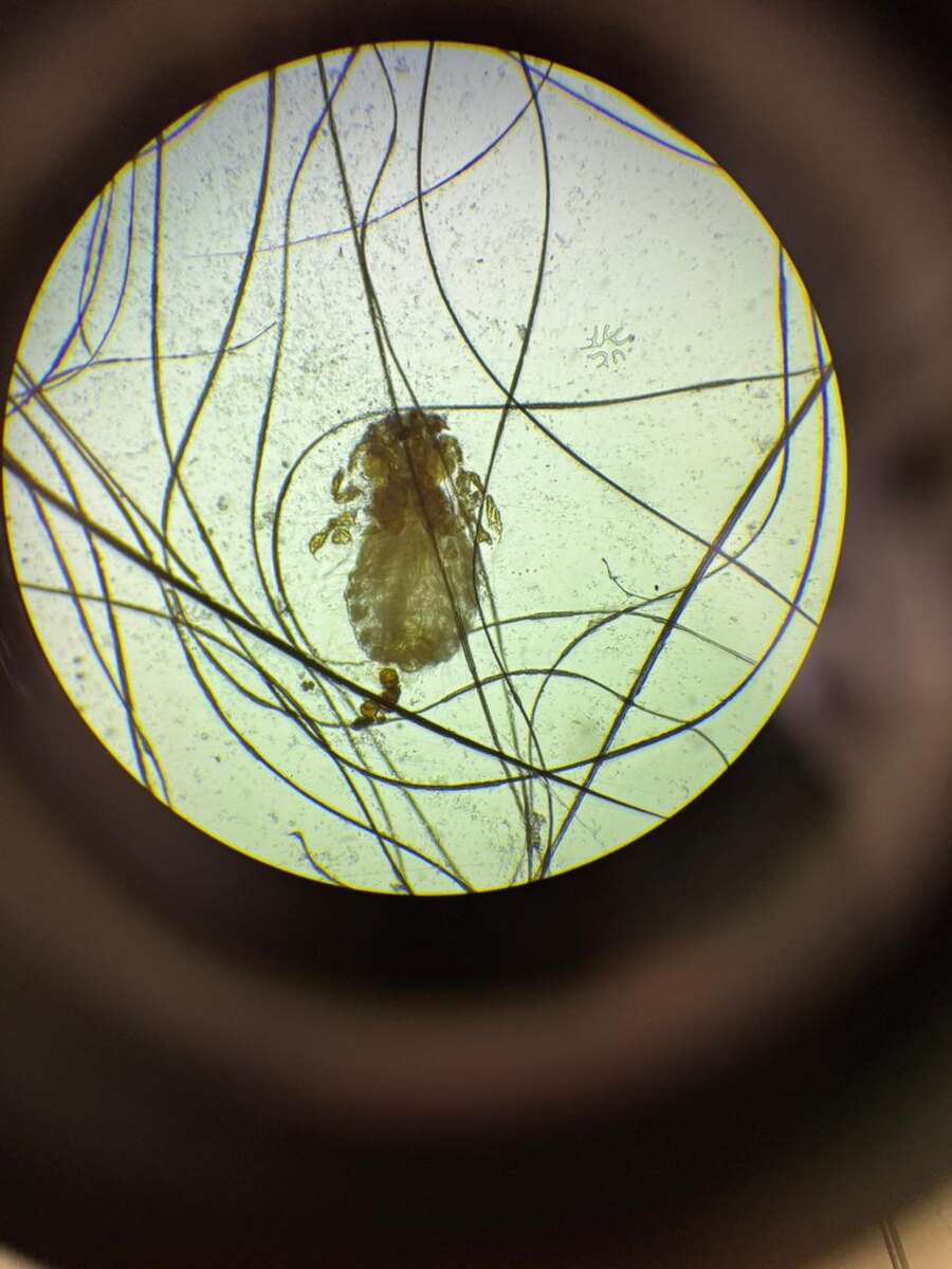 Под микроскопом