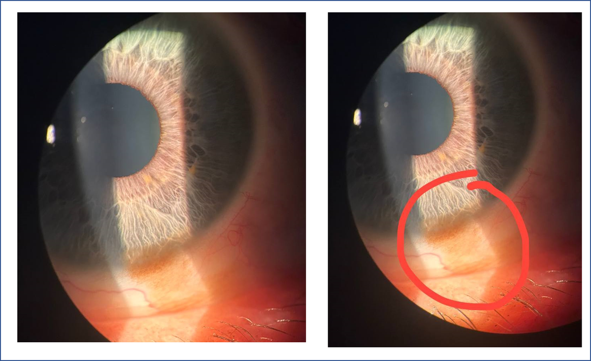 Вот что увидела доктор в окуляр прибора