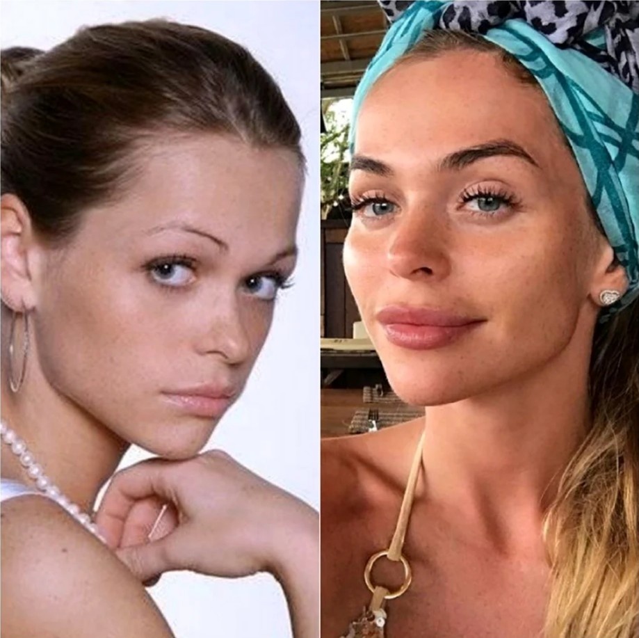 Анна Хилькевич