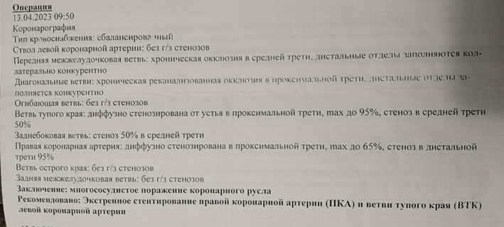 Только общий ствол и огибающая ветвь осталась без бляшек. 