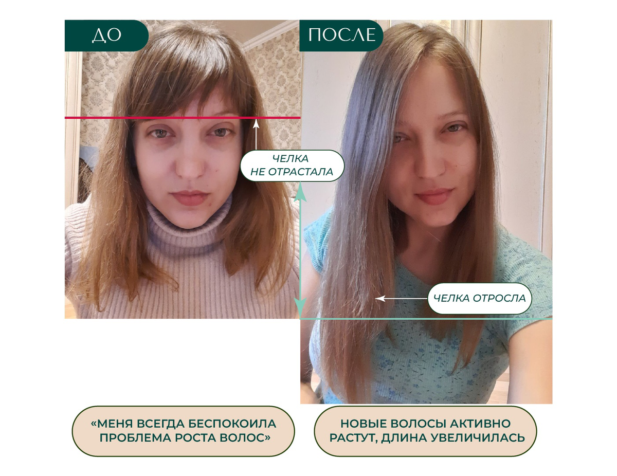 СЛЕВА: волосы Натальи до программы "Волосы мечты" - волосы сильно секлись, кончики выглядели неопрятными, рваными, сухими, путались. СПРАВА: волосы Натальи после программы "Волосы мечты" - длинные, гладкие и блестящие.