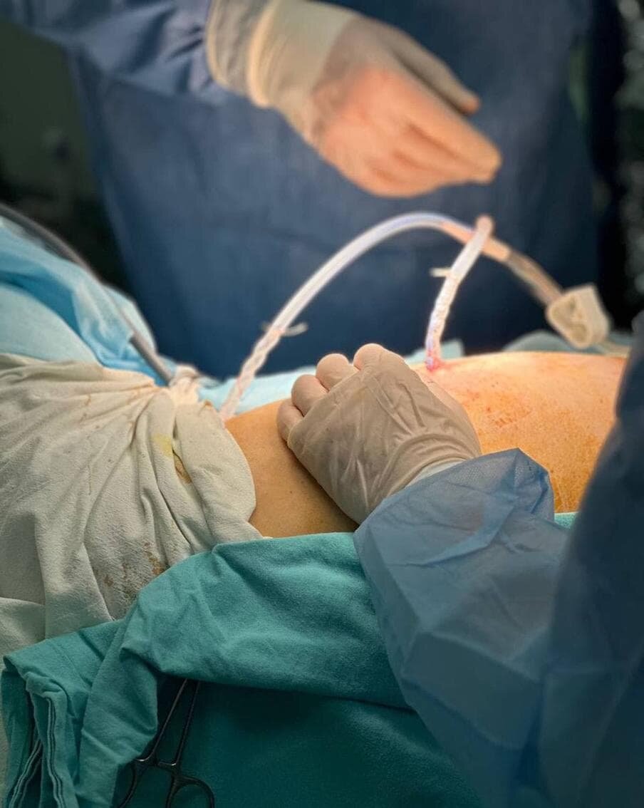    Дренирование плевральной полости. Сергей Муравьёв