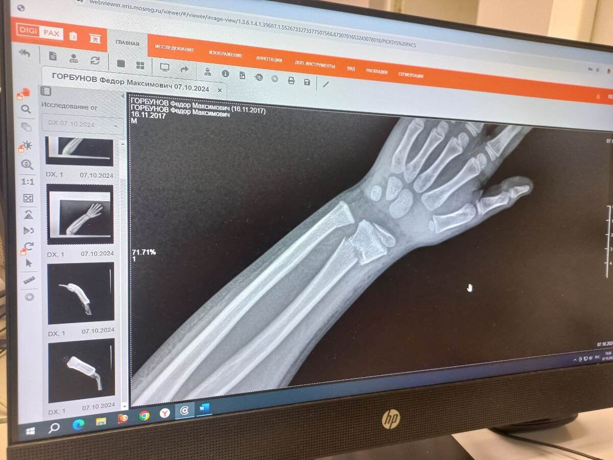 Снимок до лечения