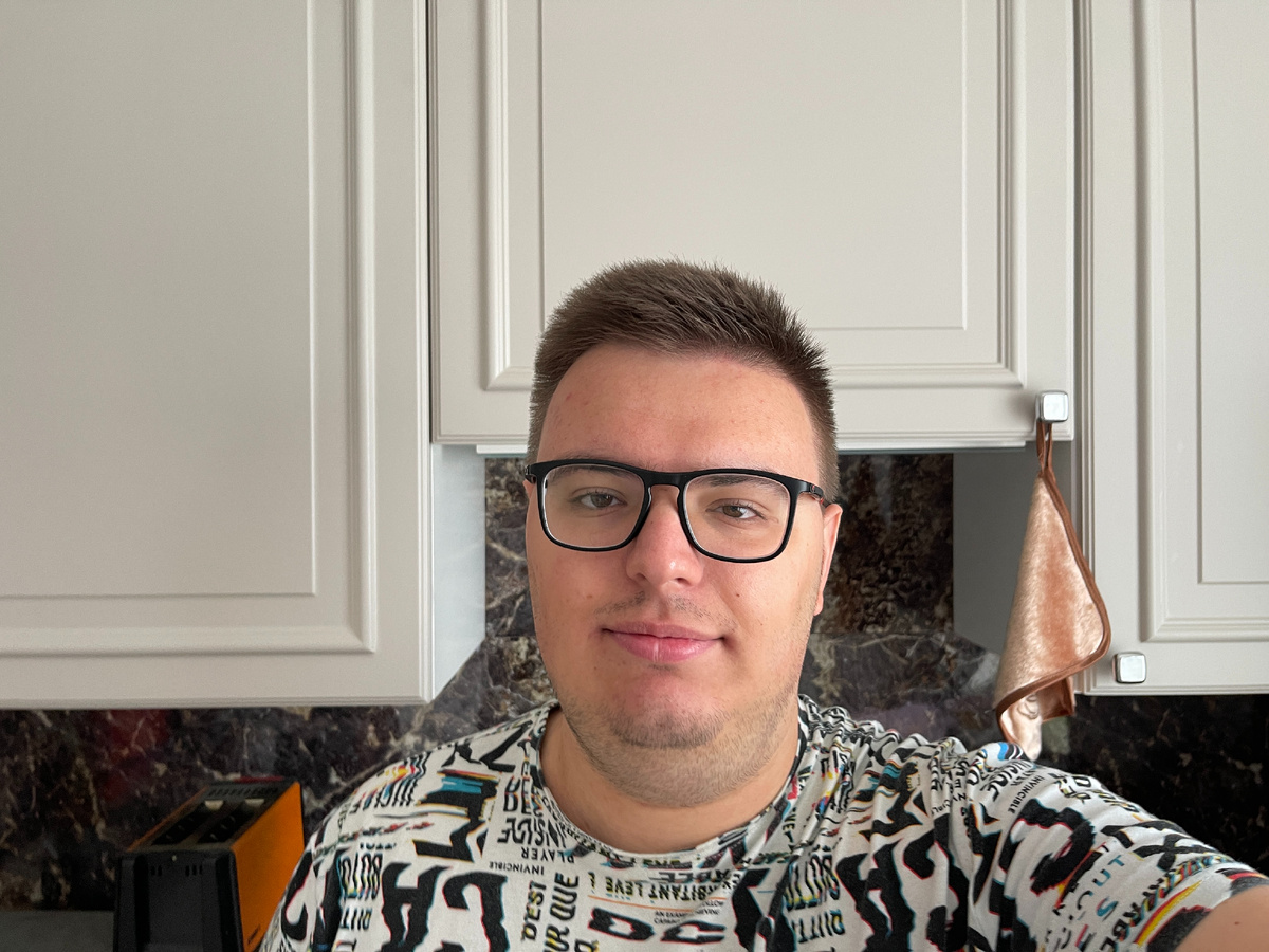 Примерно так выглядел, когда посетил врача. Справа видны те самые угри